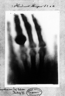 پرتو X (اشعه ایکس - X-ray)